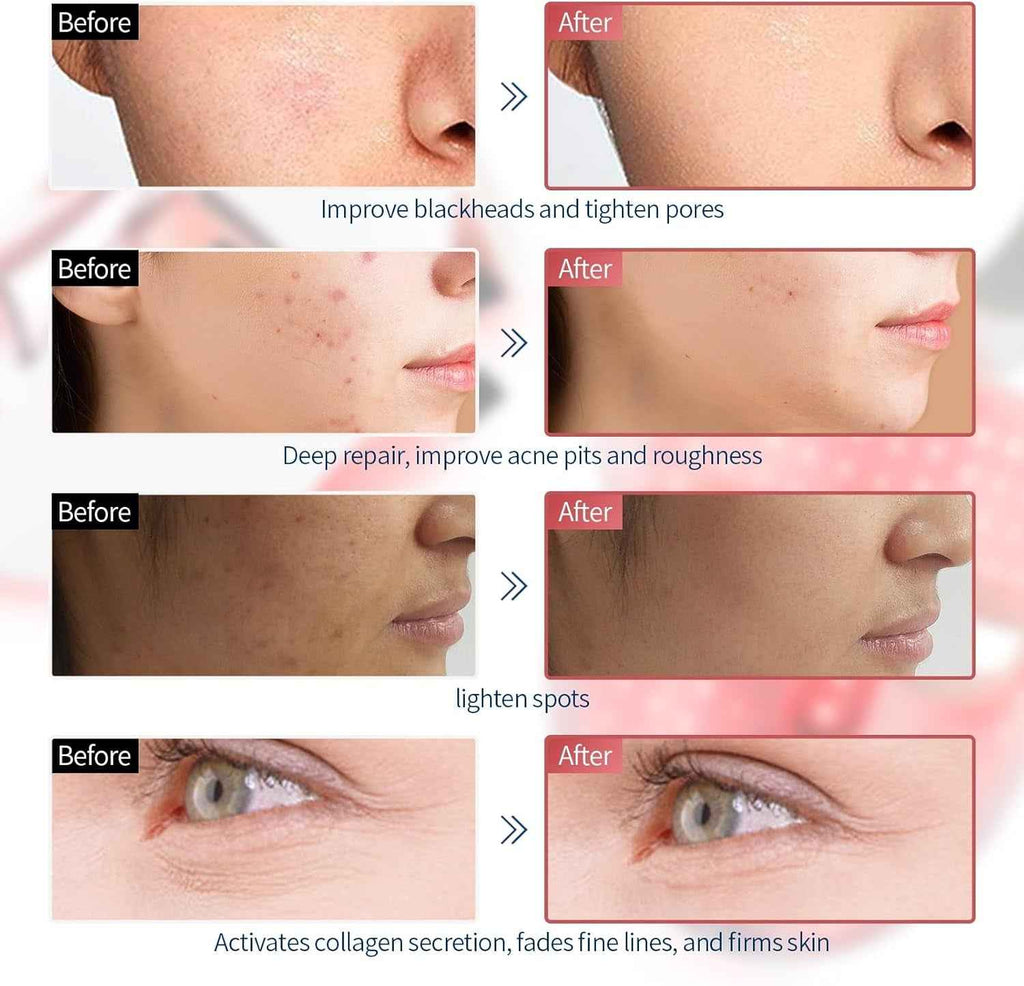 Máscara LED Facial 7 Colores - Terapia de Luz Profesional SPA